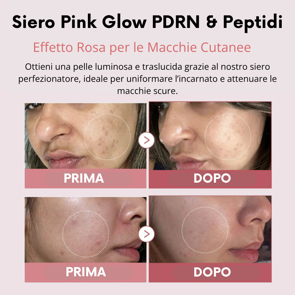 Pink Glow – Siero Coreano Anti-Macchie e Illuminante